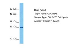 COMMD8 Rabbit anti-Human, Polyclonal, Novus Biologicals 0.1 mL | Buy Online | Novus Biologicals | Fisher Scientific